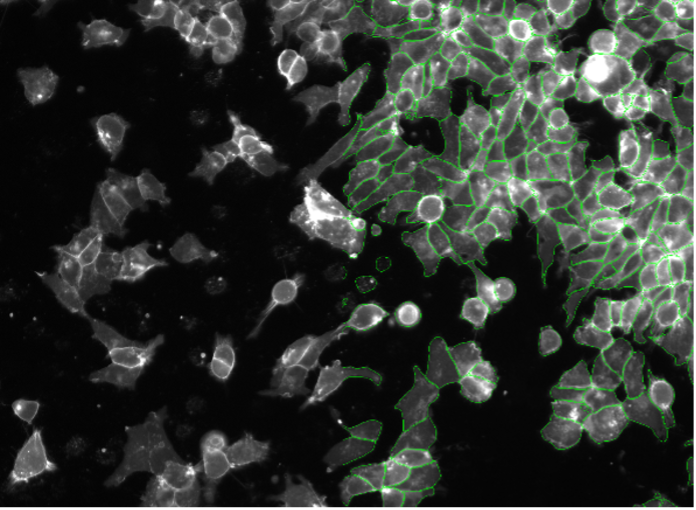 Deep learning image segmentation of SK-HEP-1 cells