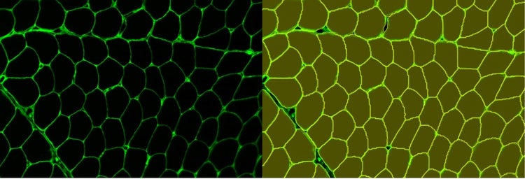 Instance segmentation of muscle fiber staining