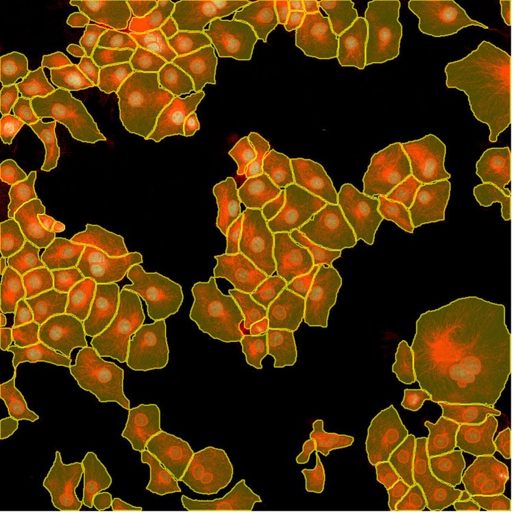 Instance segmentation of nuclei and cells using deep learning