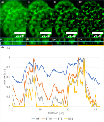 Optical sectioning improvement for SILA compared to widefield imaging