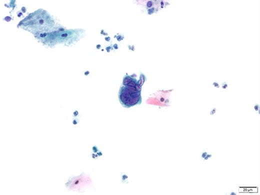 Cervical Cytology